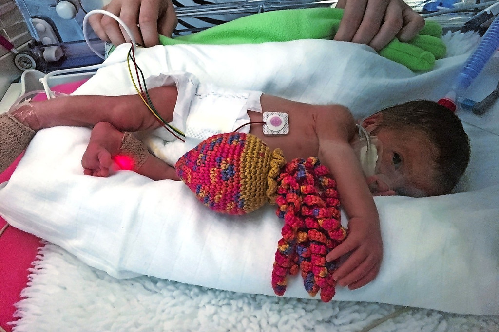 Baby Ilyana kreeg op de neonatale afdeling van het UZ Leuven een octopusje, gehaakt door CoCopus. © Jens Messner